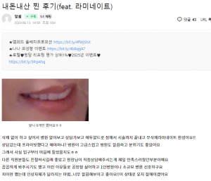 무삭제-라미네이트-후기4